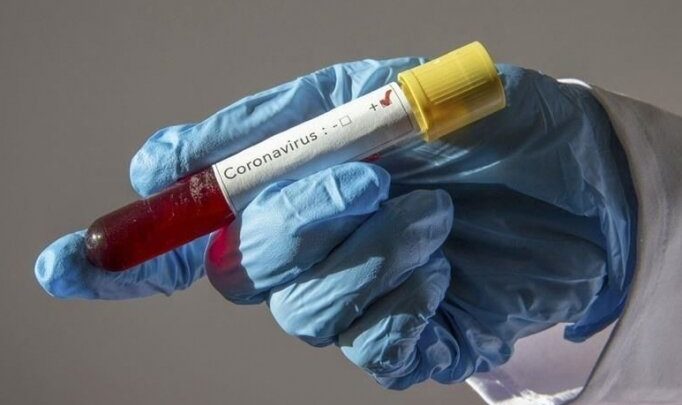 Kayserispor'da bir kişinin koronavirüs testi artı çıktı